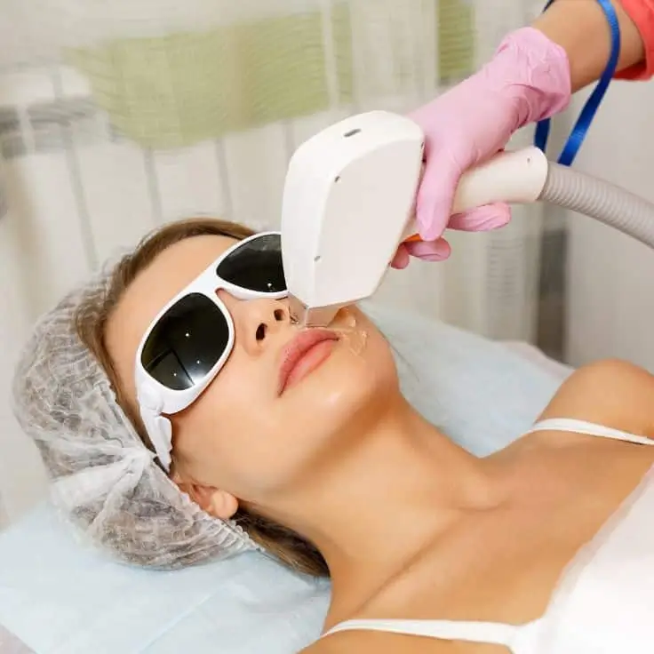 face laser hair removal in delhi