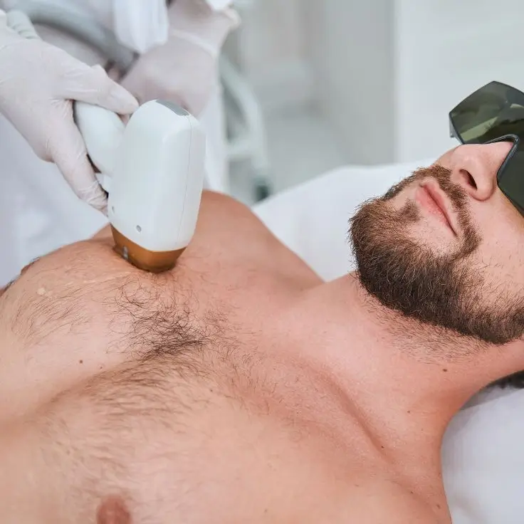 front laser hair removal in delhi