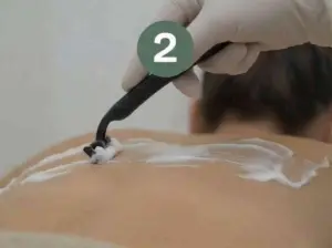 shaving the area laser hair removal